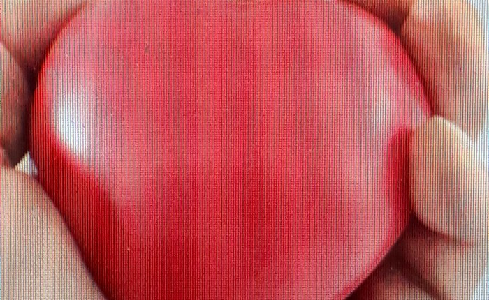 Photopheresis: one more&nbsp;time…