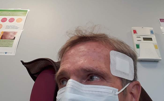 Dynamic phototherapy: https://en.wikipedia.org/wiki/Photodynamic_therapy